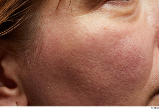 HD Face Skin Charity Sarumpaet cheek face skin pores skin…